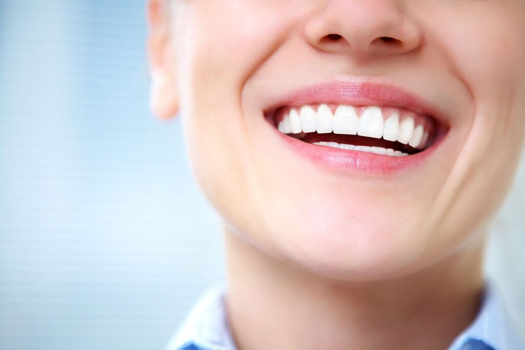 Choose Expert Teeth Whitening